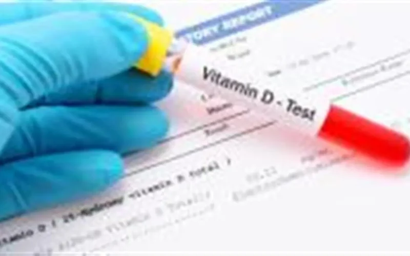 تفاصيل أسعار تحليل فيتامين D في المعامل الطبية وإجراءات الاستعداد